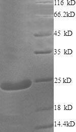 Greater than 90% as determined by SDS-PAGE.Recombinant Human Cysteine And Glycine-Rich Protein 2 (CSRP2) Protein (His)