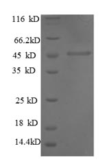 Greater than 90% as determined by SDS-PAGE.Recombinant Human Interstitial Collagenase (MMP1) Protein (His)