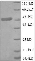 Greater than 90% as determined by SDS-PAGE.Recombinant Human Tumor Necrosis Factor Receptor Superfamily Member 1A (TNFRSF1A) Protein (GST)
