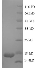 Greater than 90% as determined by SDS-PAGE.Recombinant Human Transforming Growth Factor Beta-1 Proprotein (TGFB1) Protein (His)