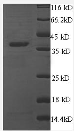 Greater than 90% as determined by SDS-PAGE.Recombinant Human Thrombospondin-1 (THBS1) Protein (His)