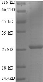Greater than 90% as determined by SDS-PAGE.Recombinant Human Metalloproteinase Inhibitor 4 (TIMP4) Protein (His)