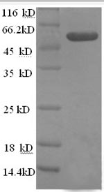 Greater than 90% as determined by SDS-PAGE.Recombinant Human Tumor Necrosis Factor Ligand Superfamily Member 10 (TNFSF10) Protein (GST)