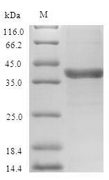 Greater than 90% as determined by SDS-PAGE.Recombinant Human Vascular Endothelial Growth Factor C (VEGFC) Protein (GST)