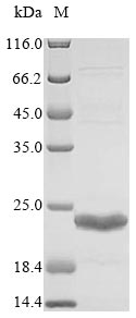 Greater than 90% as determined by SDS-PAGE.Recombinant Acinetobacter Baumannii Beta-Lactamase (NDM-1) Protein (His-SUMO)