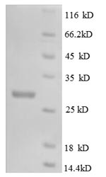 Greater than 90% as determined by SDS-PAGE.