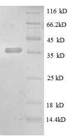 Greater than 90% as determined by SDS-PAGE.Recombinant Rat Chemokine  (CXCL13) Protein (GST)