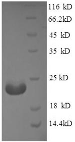 Greater than 90% as determined by SDS-PAGE.Recombinant Mouse Adiponectin (ADIPOQ) Protein (His)