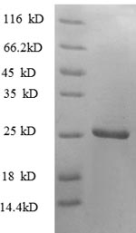 Greater than 90% as determined by SDS-PAGE.Recombinant Human Tumor Necrosis Factor Ligand Superfamily Member 9 Protein (TNFSF9) Protein (His)