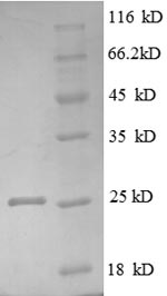 Greater than 90% as determined by SDS-PAGE.Recombinant Human Tumor Necrosis Factor Receptor Superfamily Member 3 (LTBR) Protein (His)