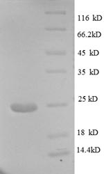 Greater than 90% as determined by SDS-PAGE.Recombinant Human Papillomavirus Type 18 L1 Protein (L1) Protein (His)