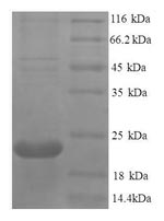 Greater than 90% as determined by SDS-PAGE.Recombinant Human Tumor Necrosis Factor Receptor Superfamily Member 11A (TNFRSF11A) Protein (His)