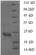 Greater than 90% as determined by SDS-PAGE.Recombinant E.Coli 30S Ribosomal Protein S7 (RPSG) Protein (His)