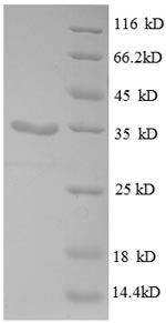 Greater than 90% as determined by SDS-PAGE.Recombinant E.Coli 30S Ribosomal Protein S21 (RPSU) Protein (GST)