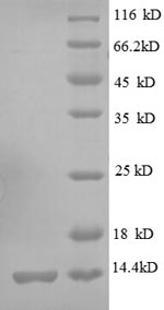 Greater than 90% as determined by SDS-PAGE.Recombinant E.Coli 30S Ribosomal Protein S19 (RPSS) Protein (His)