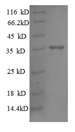 Greater than 90% as determined by SDS-PAGE.Recombinant E.Coli 30S Ribosomal Protein S18 (RPSR) Protein (GST)
