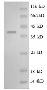Greater than 90% as determined by SDS-PAGE.Recombinant E.Coli 30S Ribosomal Protein S13 (RPSM) Protein (GST)