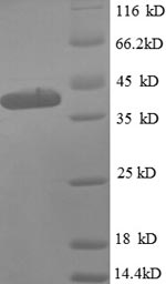 Greater than 90% as determined by SDS-PAGE.Recombinant E.Coli 50S Ribosomal Protein L9 (RPLI) Protein (GST)