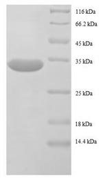Greater than 90% as determined by SDS-PAGE.Recombinant E.Coli 50S Ribosomal Protein L32 (RPMF) Protein (GST)