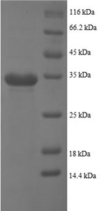 Greater than 90% as determined by SDS-PAGE.Recombinant Human Platelet Basic Protein (PPBP) Protein (GST)