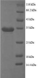 Greater than 90% as determined by SDS-PAGE.