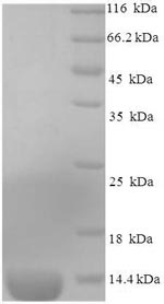 Greater than 90% as determined by SDS-PAGE.Recombinant Mouse C-C Motif Chemokine 2 (CCL2) Protein (His)