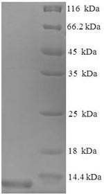 Greater than 90% as determined by SDS-PAGE.Recombinant Mouse C-C Motif Chemokine 3 (CCL3) Protein (His)