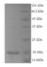 Greater than 90% as determined by SDS-PAGE.Recombinant Mouse C-C Motif Chemokine 25 (CCL25) Protein (His)