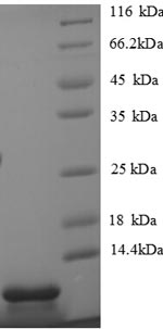 Greater than 90% as determined by SDS-PAGE.Recombinant Mouse C-X-C Motif Chemokine 5 (CXCL5) Protein (His)