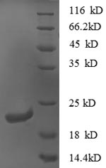 Greater than 90% as determined by SDS-PAGE.Recombinant Mouse C-X-C Motif Chemokine 16 (CXCL16) Protein (His)