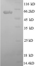 Greater than 90% as determined by SDS-PAGE.Recombinant Human Sparc (SPARC) Protein (GST)