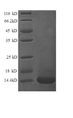 Greater than 90% as determined by SDS-PAGE.Recombinant Human Lymphotactin Protein (XCL1) Protein (His)