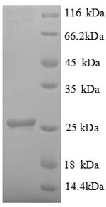 Greater than 90% as determined by SDS-PAGE.Recombinant Human Ubiquitin-Conjugating Enzyme E2 K (UBE2K) Protein (His)
