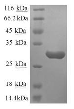 Greater than 90% as determined by SDS-PAGE.Recombinant Human Substance-P Receptor (TACR1) Protein (GST)