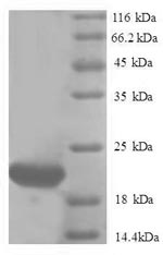 Greater than 90% as determined by SDS-PAGE.Recombinant Human Ubiquitin-Like Protein Isg15 (ISG15) Protein (His)