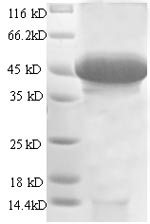 Greater than 90% as determined by SDS-PAGE.Recombinant Human Stanniocalcin-1 (STC1) Protein (GST)