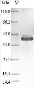 Greater than 90% as determined by SDS-PAGE.Recombinant Human Stanniocalcin-1 (STC1) Protein (His-SUMO)