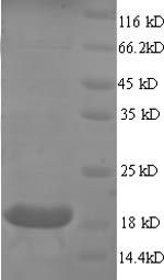 Greater than 90% as determined by SDS-PAGE.Recombinant Human Myosin Regulatory Light Chain 2, Ventricular/Cardiac Muscle Isoform (MYL2) Protein (His)