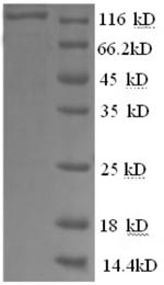 Greater than 90% as determined by SDS-PAGE.Recombinant Human Glycogen Phosphorylase, Brain Form (PYGB) Protein (GST)