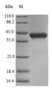 Greater than 90% as determined by SDS-PAGE.Recombinant Human Decorin (DCN) Protein (His)