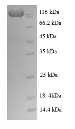 Greater than 90% as determined by SDS-PAGE.Recombinant Human Nuclear Factor Nf-Kappa-B P105 Subunit (NFKB1) Protein (GST)