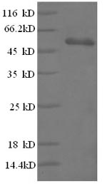 Greater than 90% as determined by SDS-PAGE.Recombinant Human T-Cell Surface Glycoprotein Cd3 Epsilon Chain (CD3E) Protein (GST)