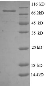 Greater than 90% as determined by SDS-PAGE.Recombinant Human 5'-Nucleotidase (NT5E) Protein (GST)