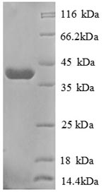 Greater than 90% as determined by SDS-PAGE.Recombinant Human Golgi Membrane Protein 1 (GOLM1) Protein (GST)