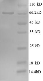 Greater than 90% as determined by SDS-PAGE.Recombinant Human Golgi Membrane Protein 1 (GOLM1) Protein (GST)