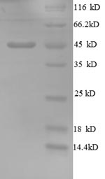 Greater than 90% as determined by SDS-PAGE.Recombinant Human Golgi Membrane Protein 1 (GOLM1) Protein (His)