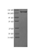 Greater than 90% as determined by SDS-PAGE.Recombinant Human Granulocyte Colony-Stimulating Factor Receptor (CSF3R) Protein (GST)