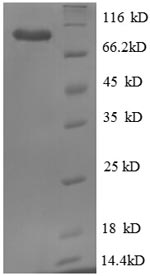 Greater than 90% as determined by SDS-PAGE.Recombinant Human Endoplasmin (HSP90B1) Protein (His)