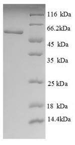Greater than 90% as determined by SDS-PAGE.Recombinant Human Phosphatidylcholine-Sterol Acyltransferase (LCAT) Protein (His)