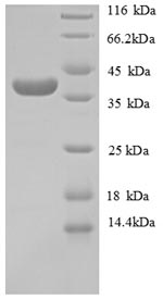Greater than 90% as determined by SDS-PAGE.Recombinant Human Collagen alpha-1 (COL4A1) Protein (GST)